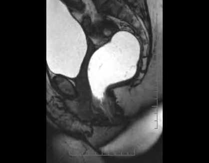dynamic pelvicmr